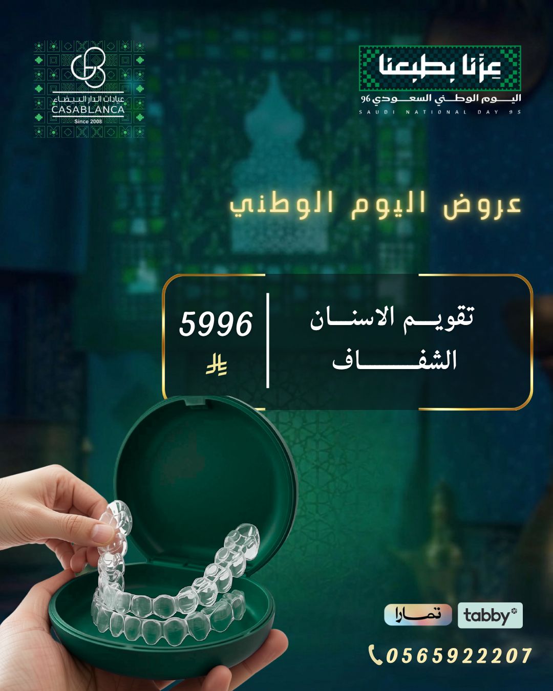التقويم الشفاف 